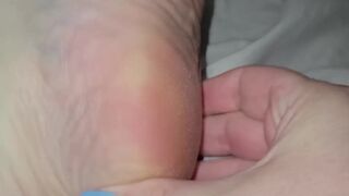Super Close Up travel of my feet soles toes 2wks after pedi-rt previous to next pedicure - 13 image